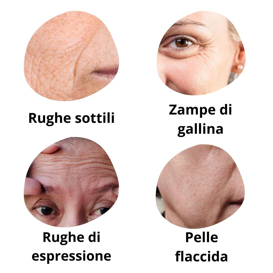 3 IN 1 ESSENTIAL: Kit FILI TENSORI di Collagene Biostimolanti+VIDEO TUTORIAL+BEAUTY BAR OMAGGIO